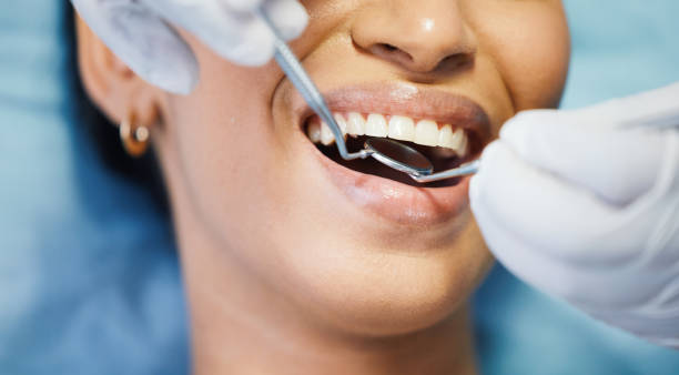 Best Emergency Dental Care for Sports Injuries in Castle Pines, CO