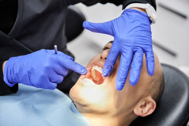Best Dental Abscess Treatment in Castle Pines, CO